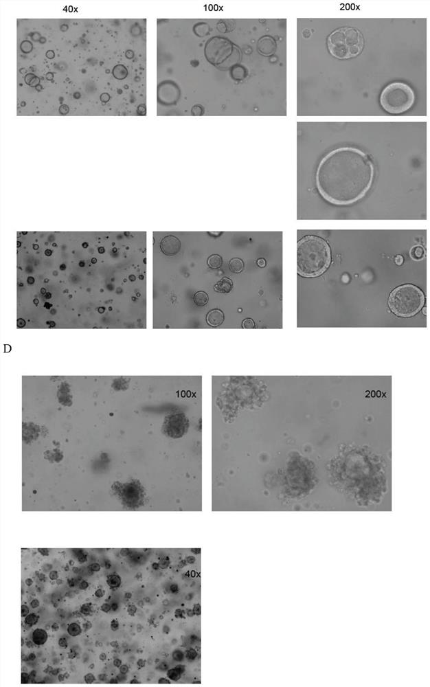 Respiratory tract organoid culture system and method for constructing bocavirus infection model