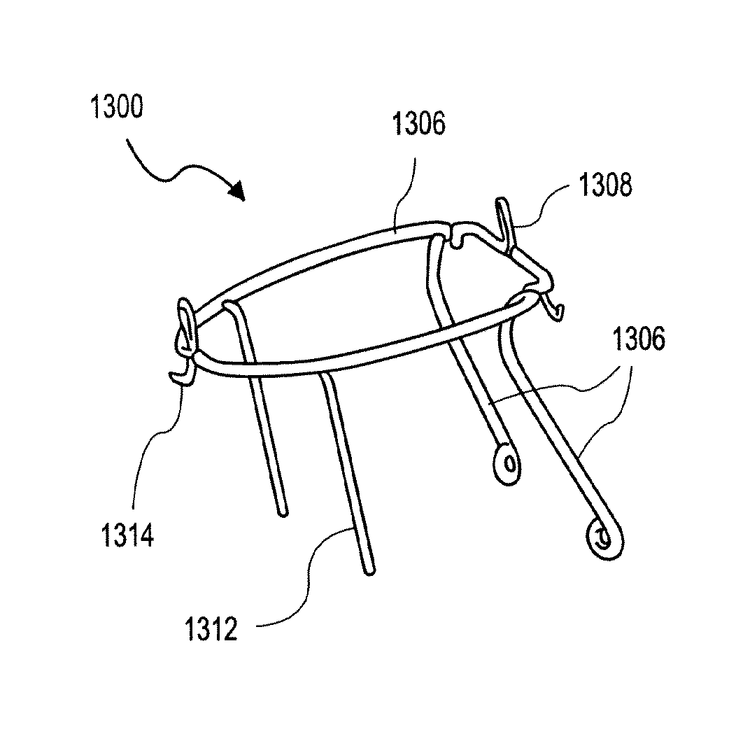 Heart valve prosthesis with collapsible valve and method of delivery thereof