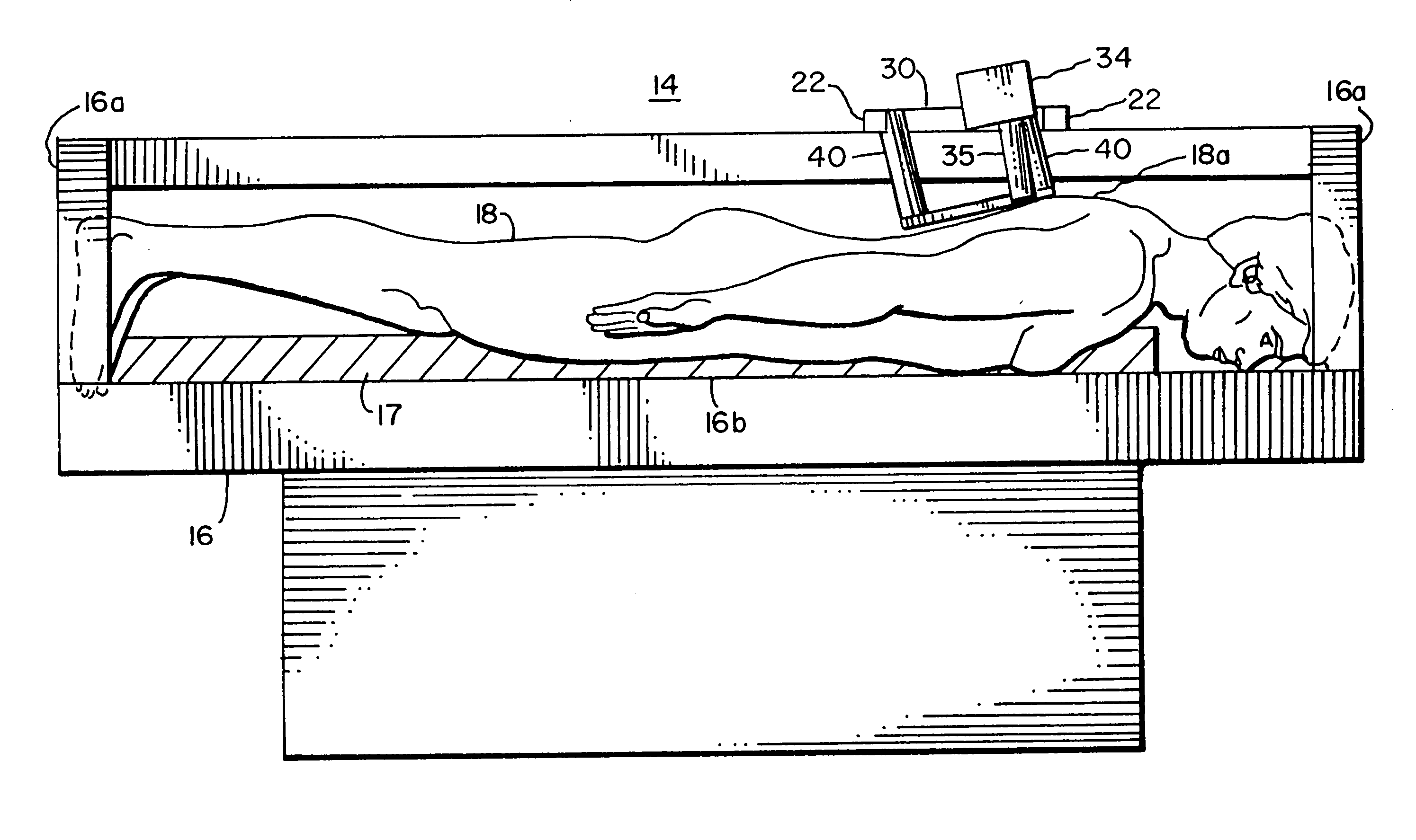 System for confocal imaging within dermal tissue