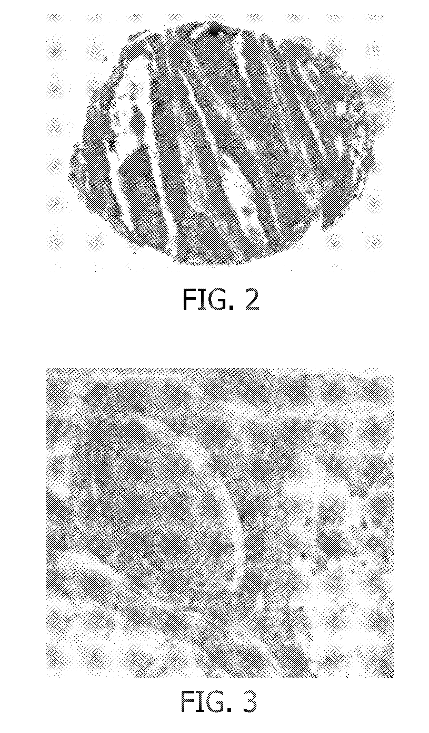 Protein-based methods and compositions for the diagnosis of colorectal adenocarcinoma