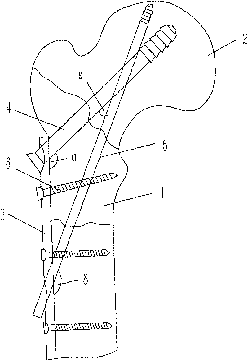 Triangle support bone fracture plate for treating fracture between femoral neck and tuberosity