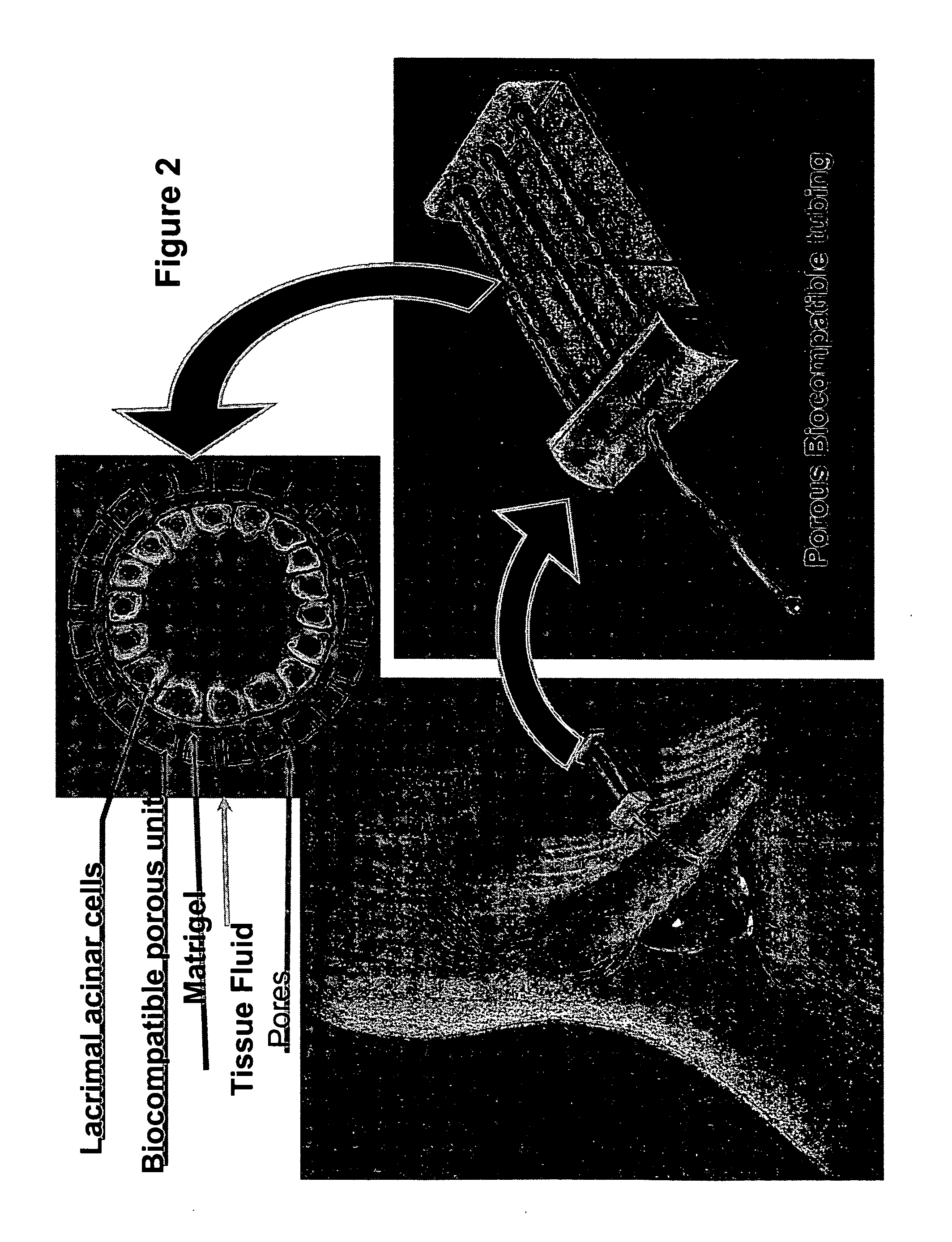 Bioartificial lacrimal gland