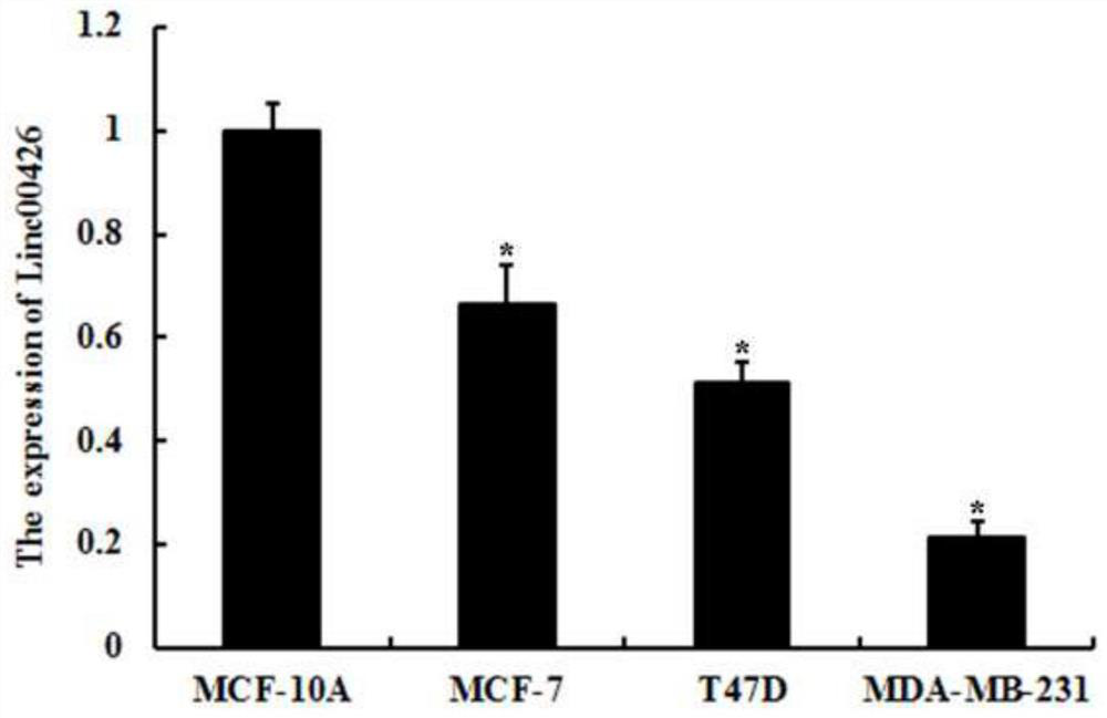 Application of a kind of lncrna in diagnosis and/or treatment of breast cancer