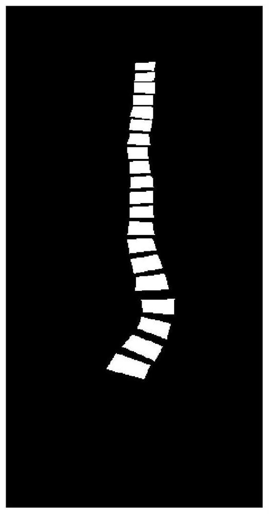 Spinal image processing method and device, electronic equipment and storage medium