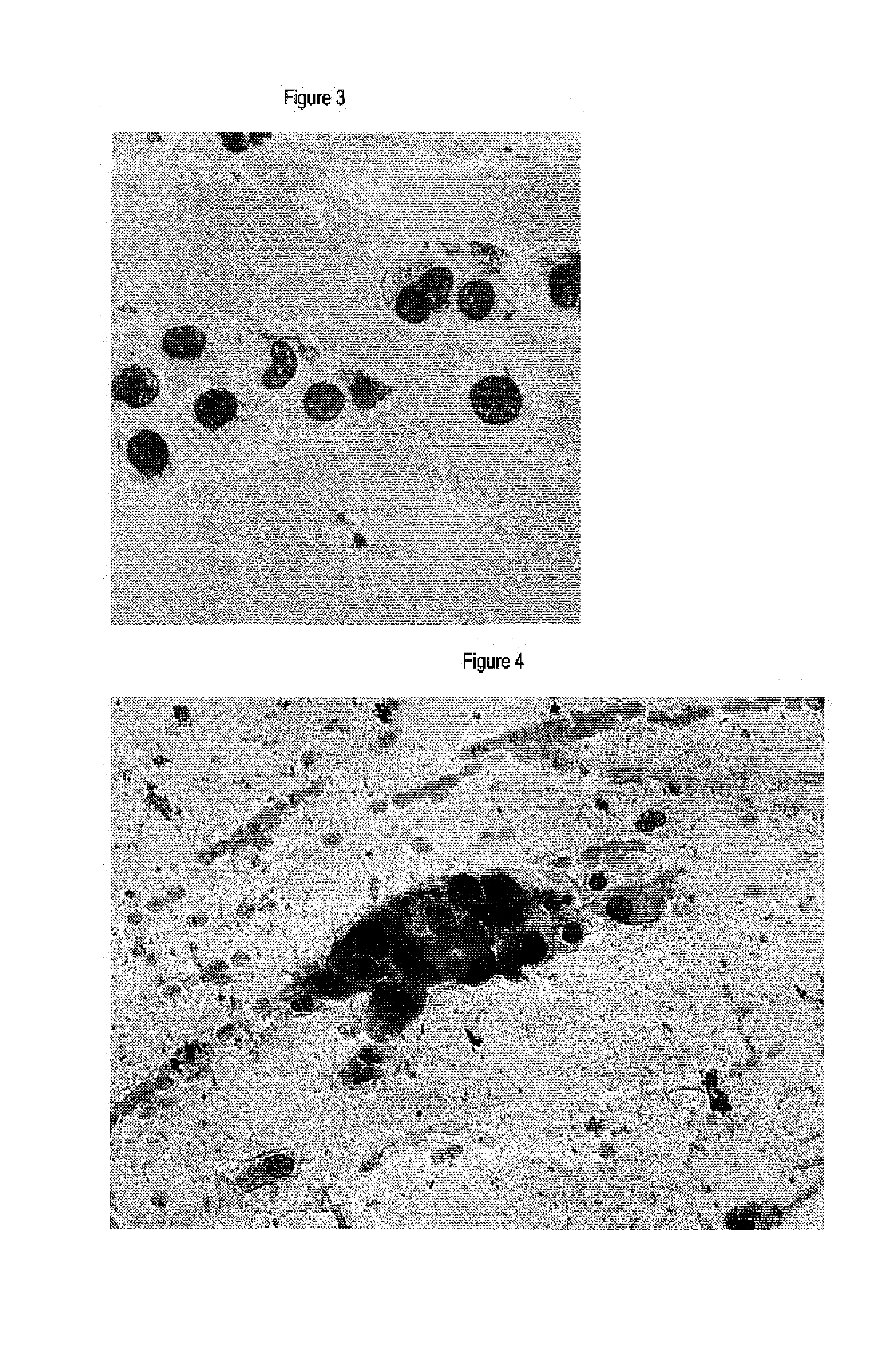 Method for discrimination of metaplasias from neoplastic or preneoplastic lesions