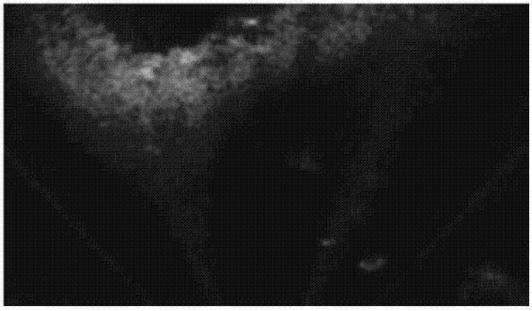 Modal MRF (Markov Random Field) based underwater forward-looking sonar image segmentation method