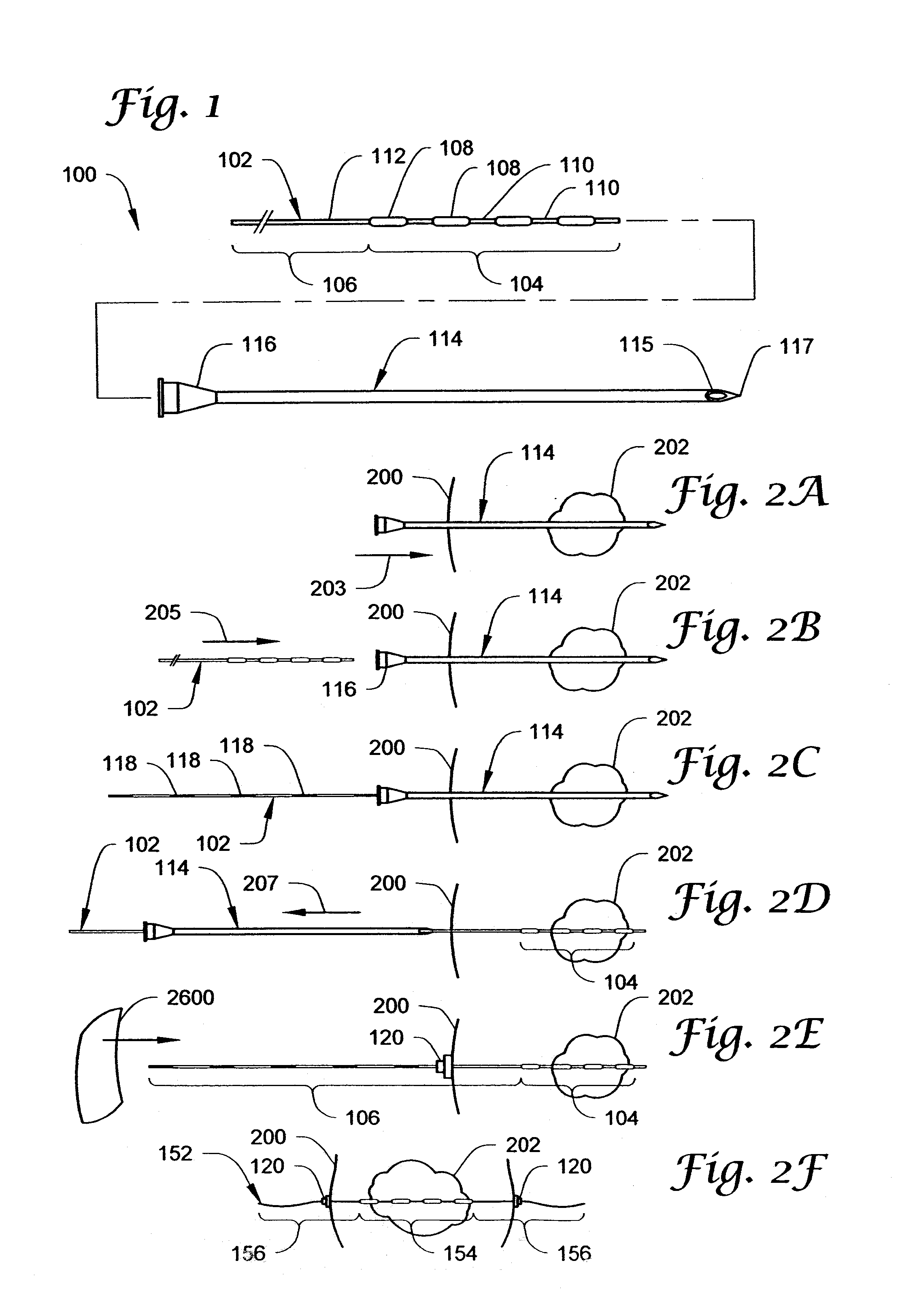 Brachytherapy apparatus and methods for using same