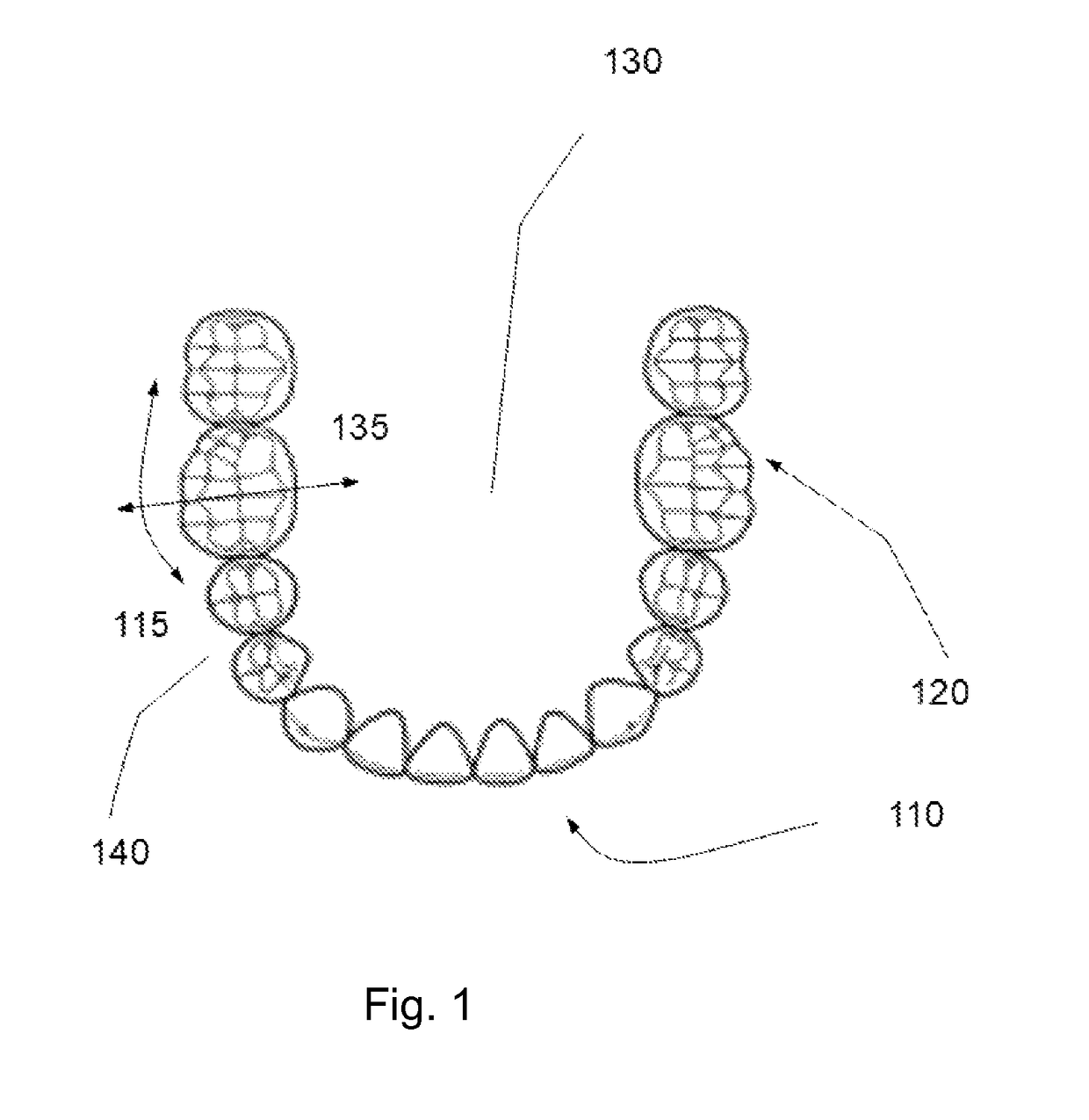 Orthodontic lingual device