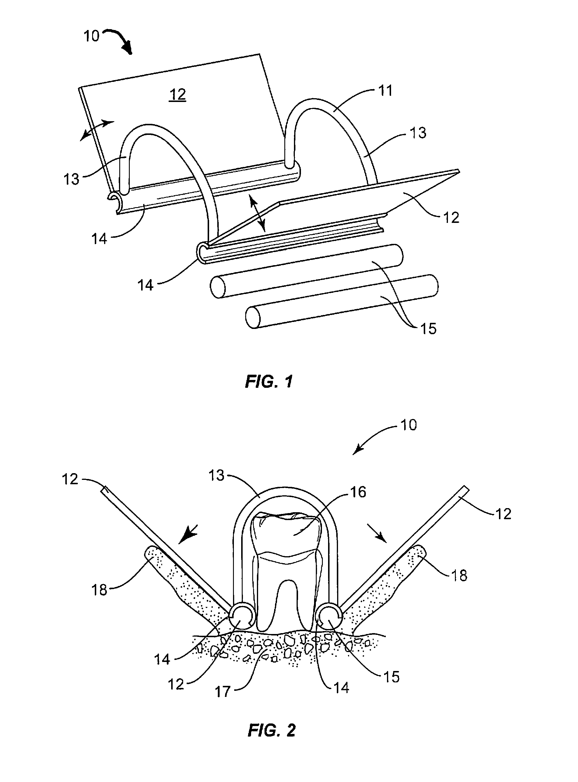 Reflected gingival tissue retractor device for surgical dental procedures, kit and method for use thereof