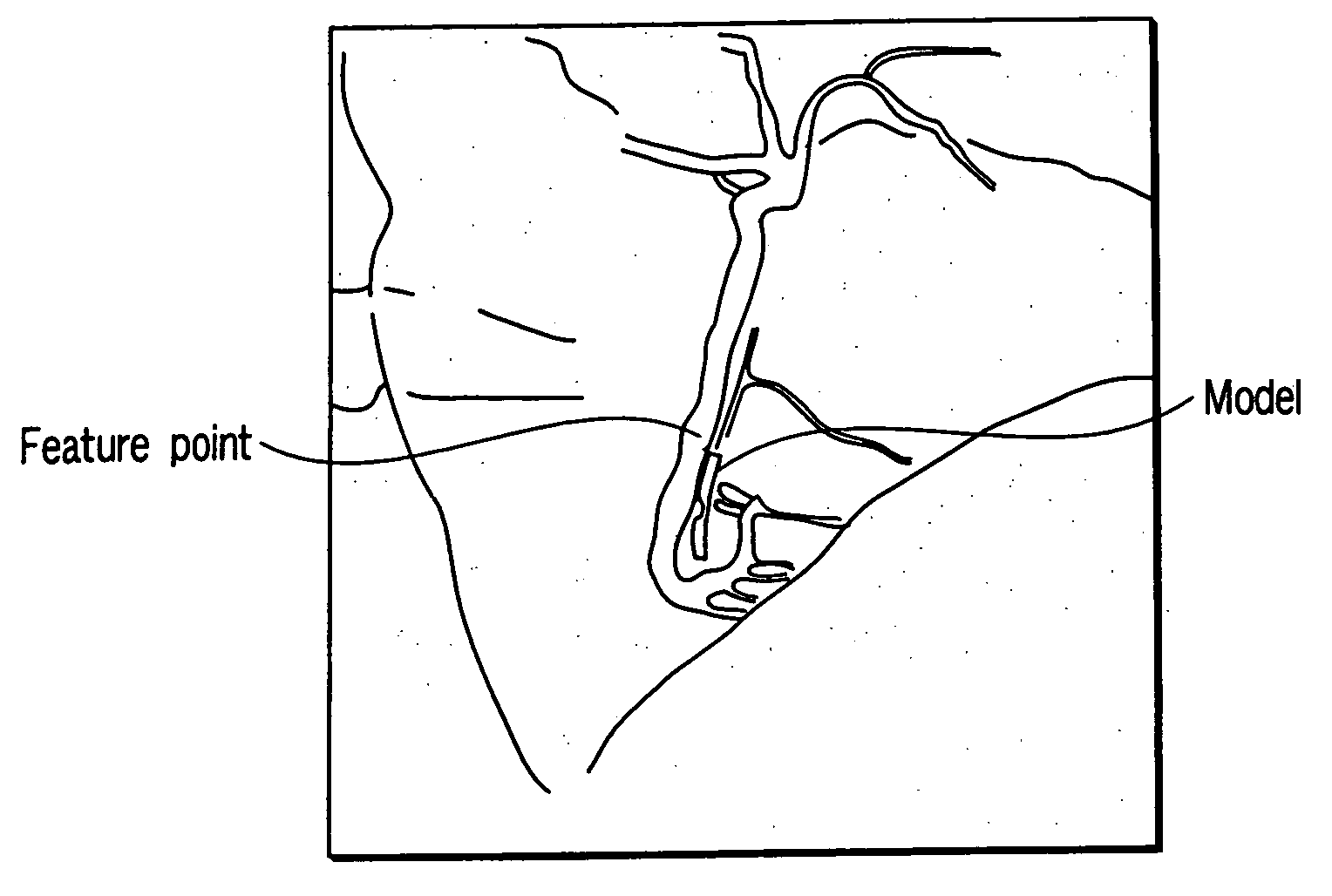 Three dimensional image processing apparatus and x-ray diagnosis apparatus