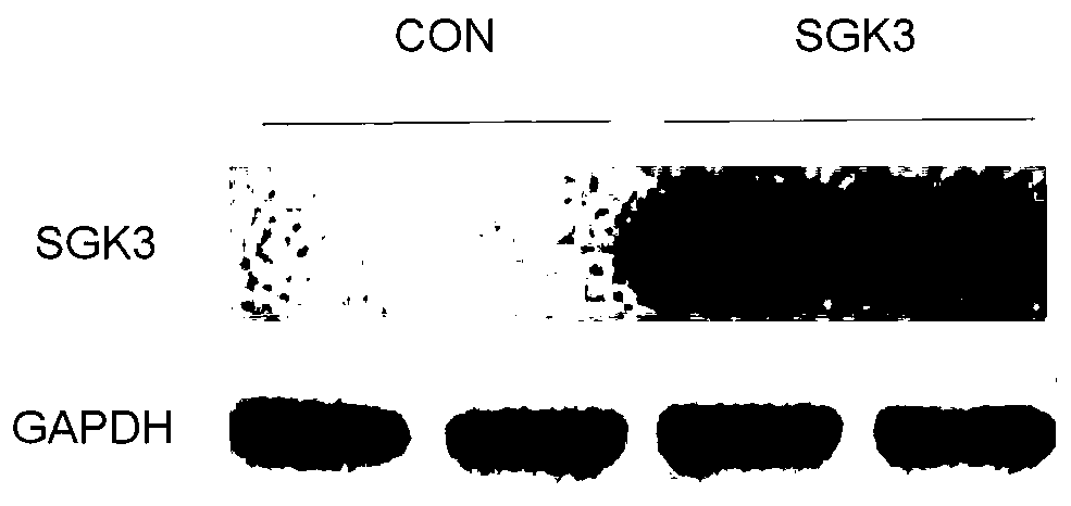 Recombinant human SGK3 protein kinase hydrogel as well as preparation method and application thereof in promoting myocardial regeneration