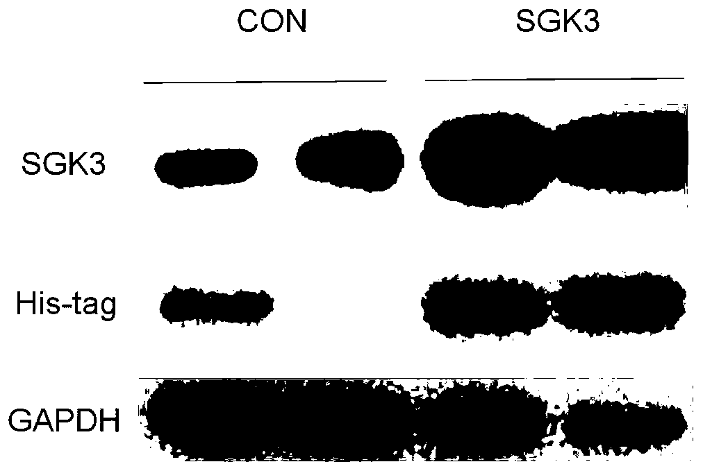 Recombinant human SGK3 protein kinase hydrogel as well as preparation method and application thereof in promoting myocardial regeneration