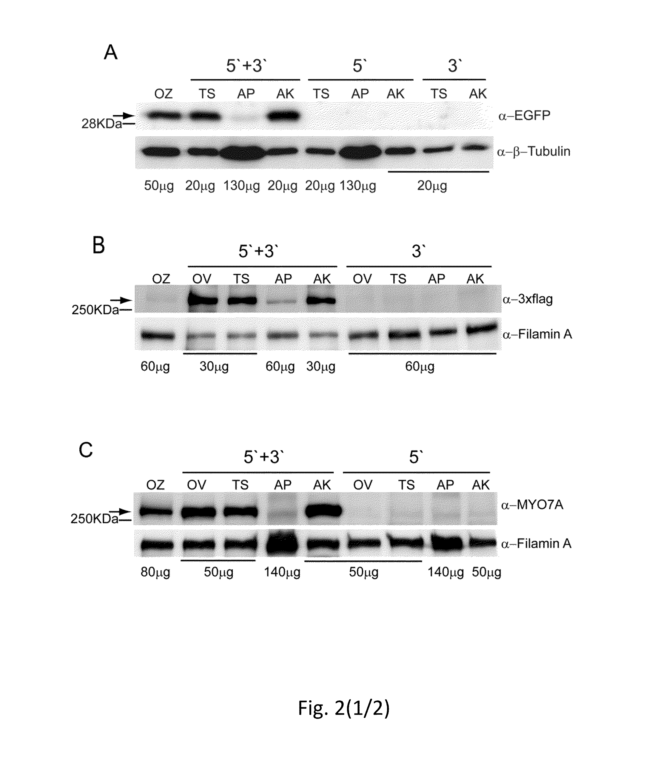 Effective delivery of large genes by dual aav vectors