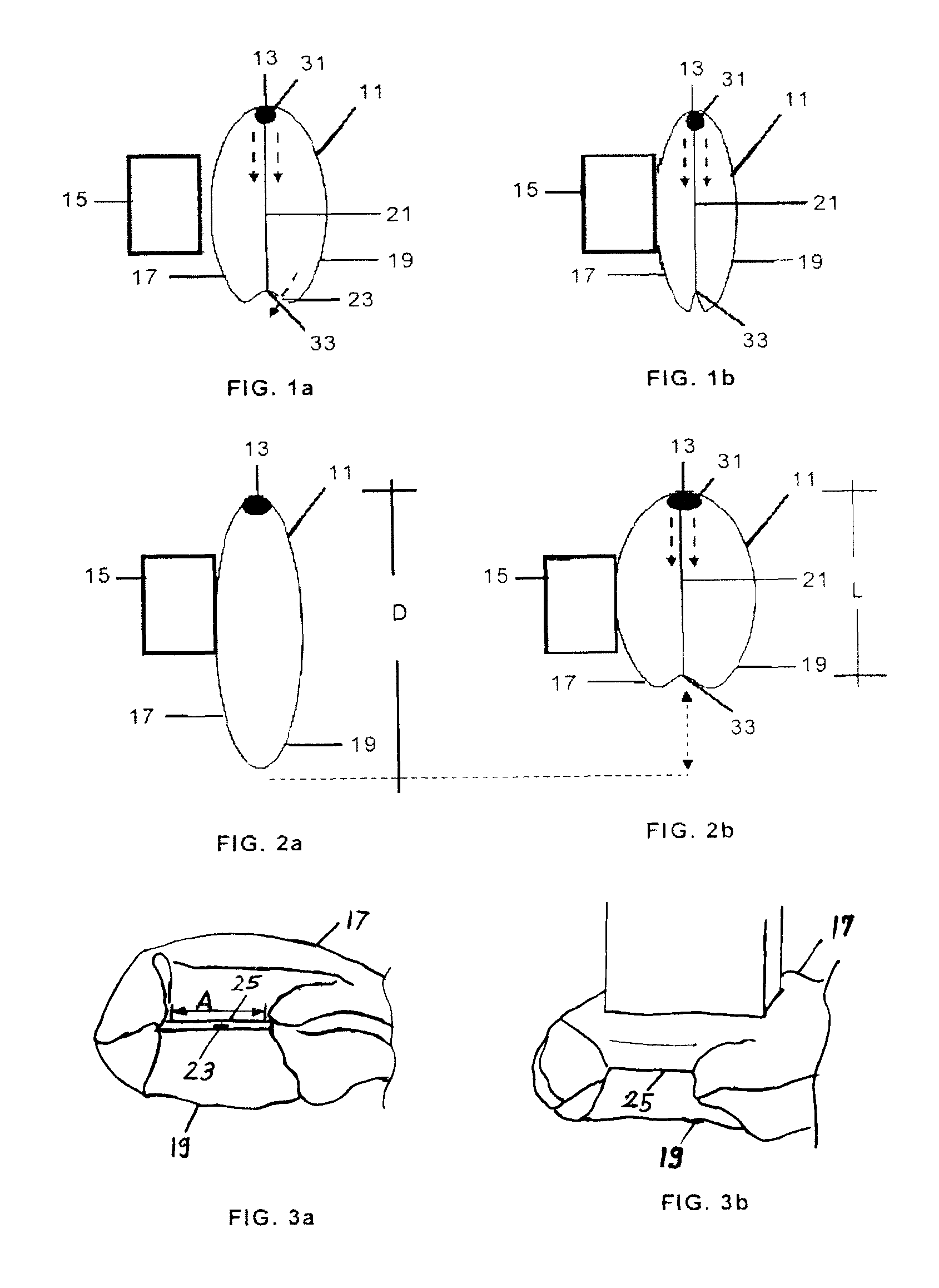 Adaptive airbag with a tension retension band that shapes bag areas into a V