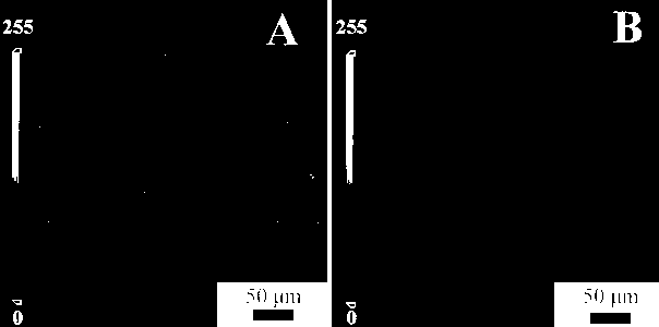 Surface-common-enhanced fluorescence surface-enhanced Raman multi-layer core-shell structure composite particles and preparation method of particles