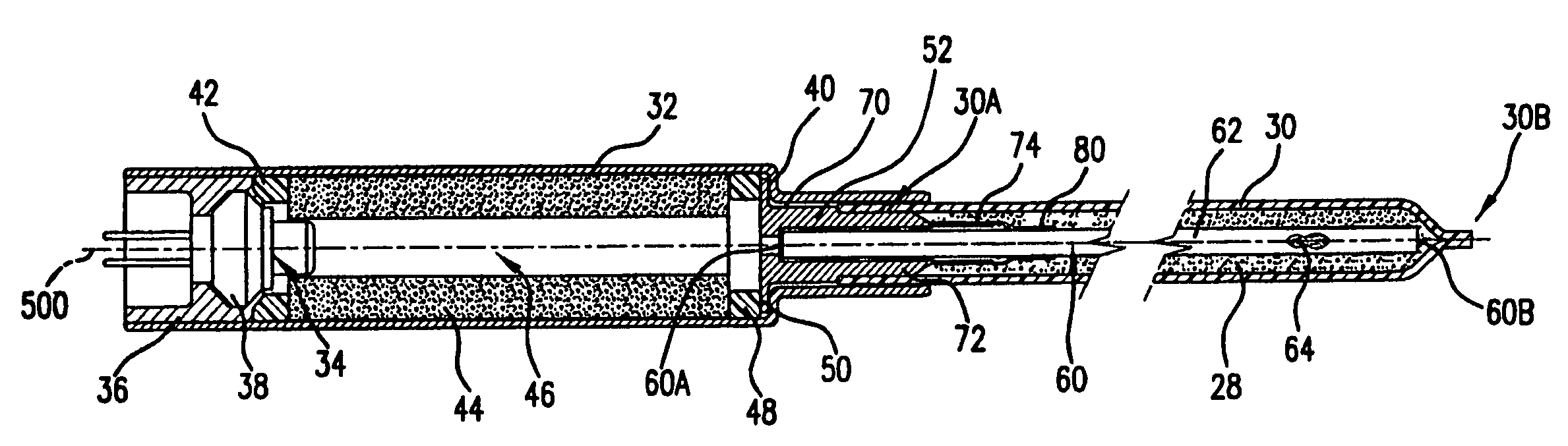 Gas generation system