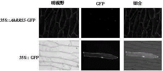 NBS-LRR (nucleotide binding site-leucine-rich repeat) gene in arachis hypogaea.L and application thereof to bacterial wilt resistance of tobaccos