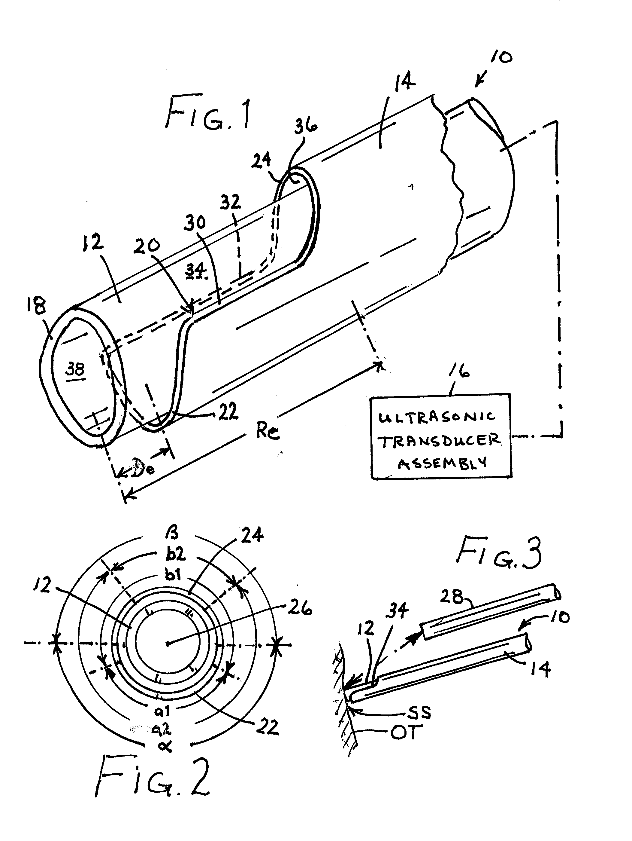 Protective sleeve and associated surgical method