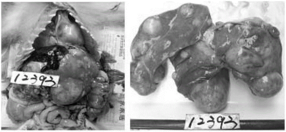 Macaca mulatta hepatocellular carcinoma model, macaca mulatta hepatocellular carcinoma cell line and application of macaca mulatta hepatocellular carcinoma model and macaca mulatta hepatocellular carcinoma cell line