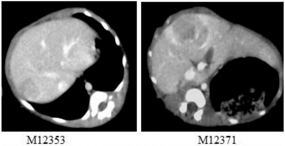 Macaca mulatta hepatocellular carcinoma model, macaca mulatta hepatocellular carcinoma cell line and application of macaca mulatta hepatocellular carcinoma model and macaca mulatta hepatocellular carcinoma cell line