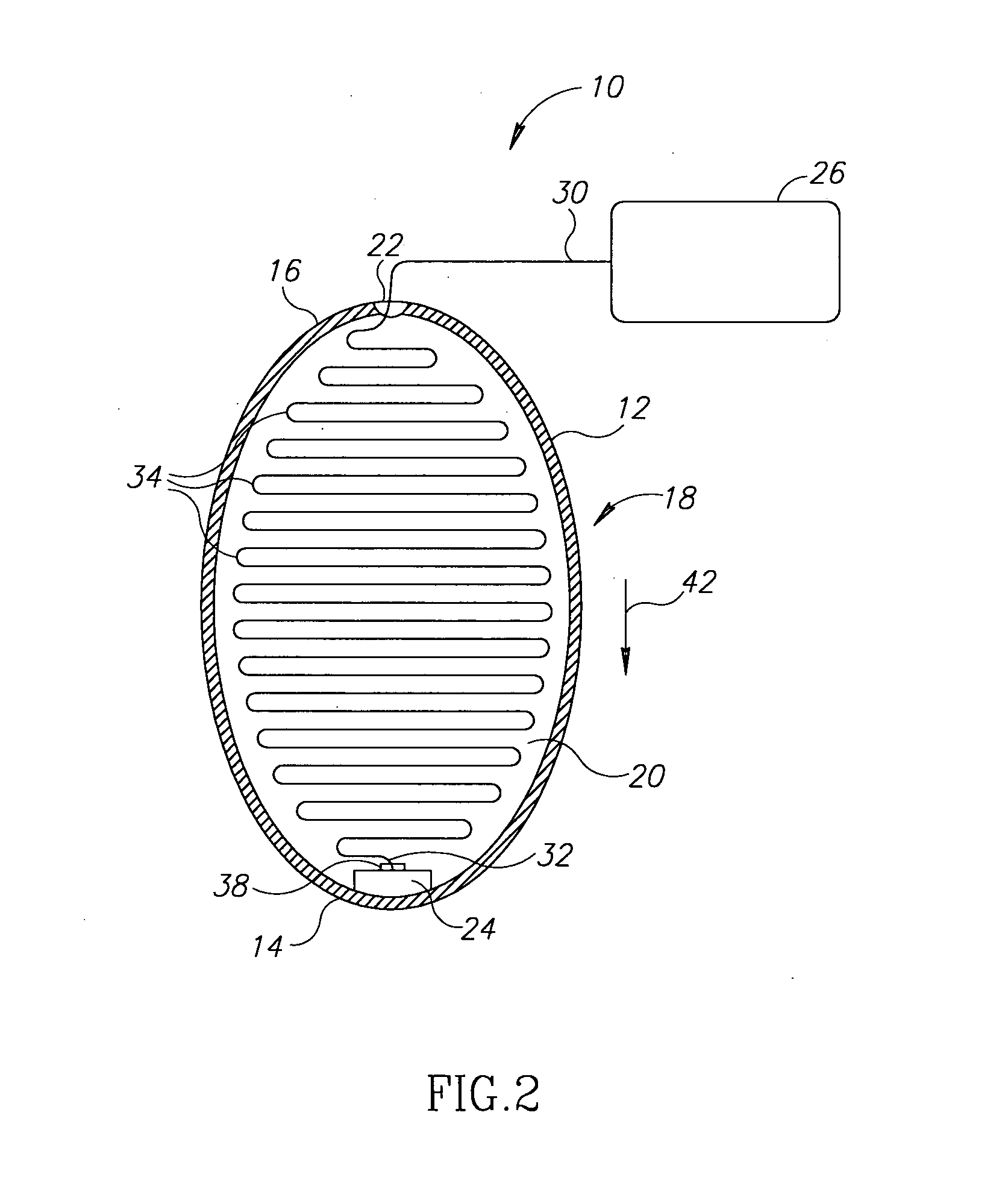 System and method for guiding of gastrointestinal device through the gastrointestinal tract