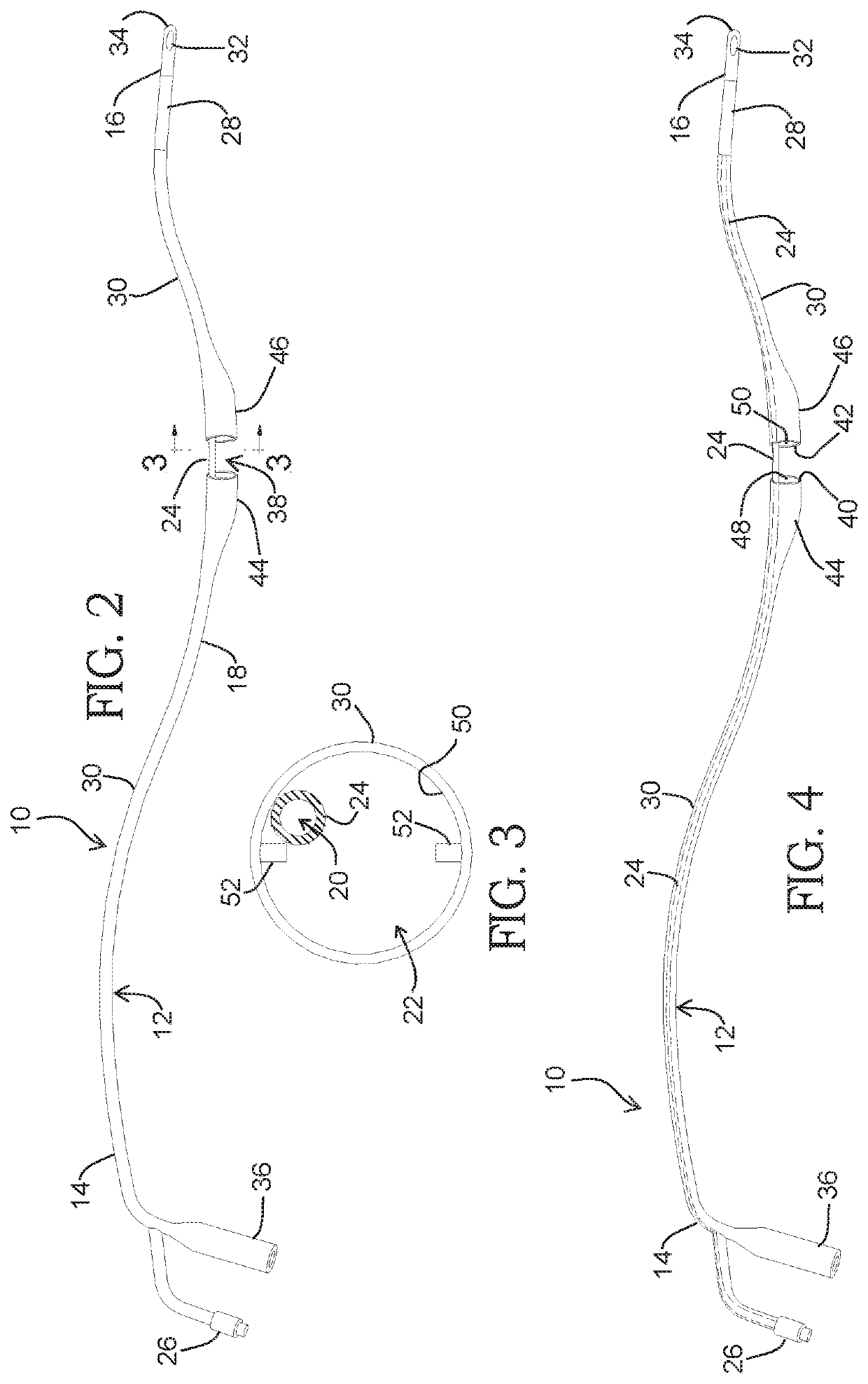 Discontinuous catheter