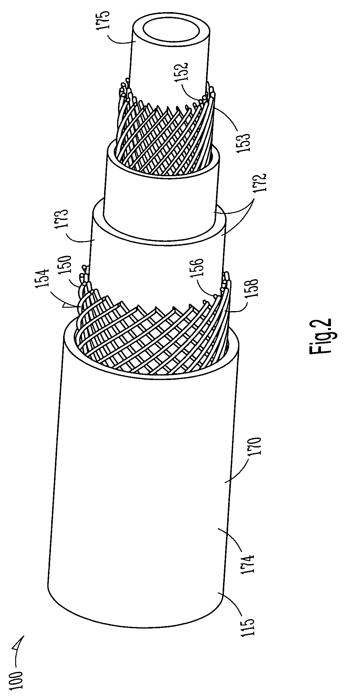 Lead having composite tubing