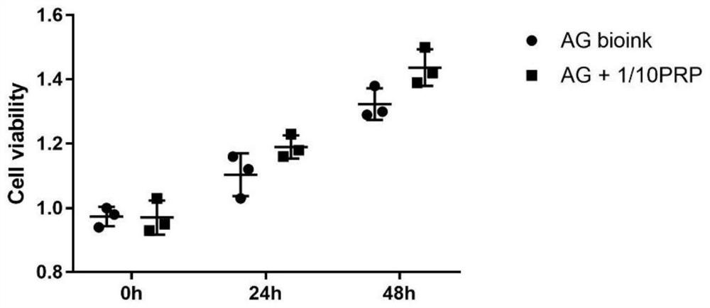 Preparation method and application of biological ink containing PRP