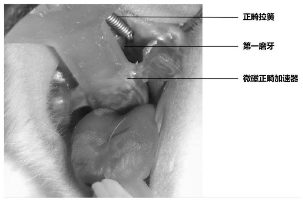 Micro-magnetic orthodontic accelerator