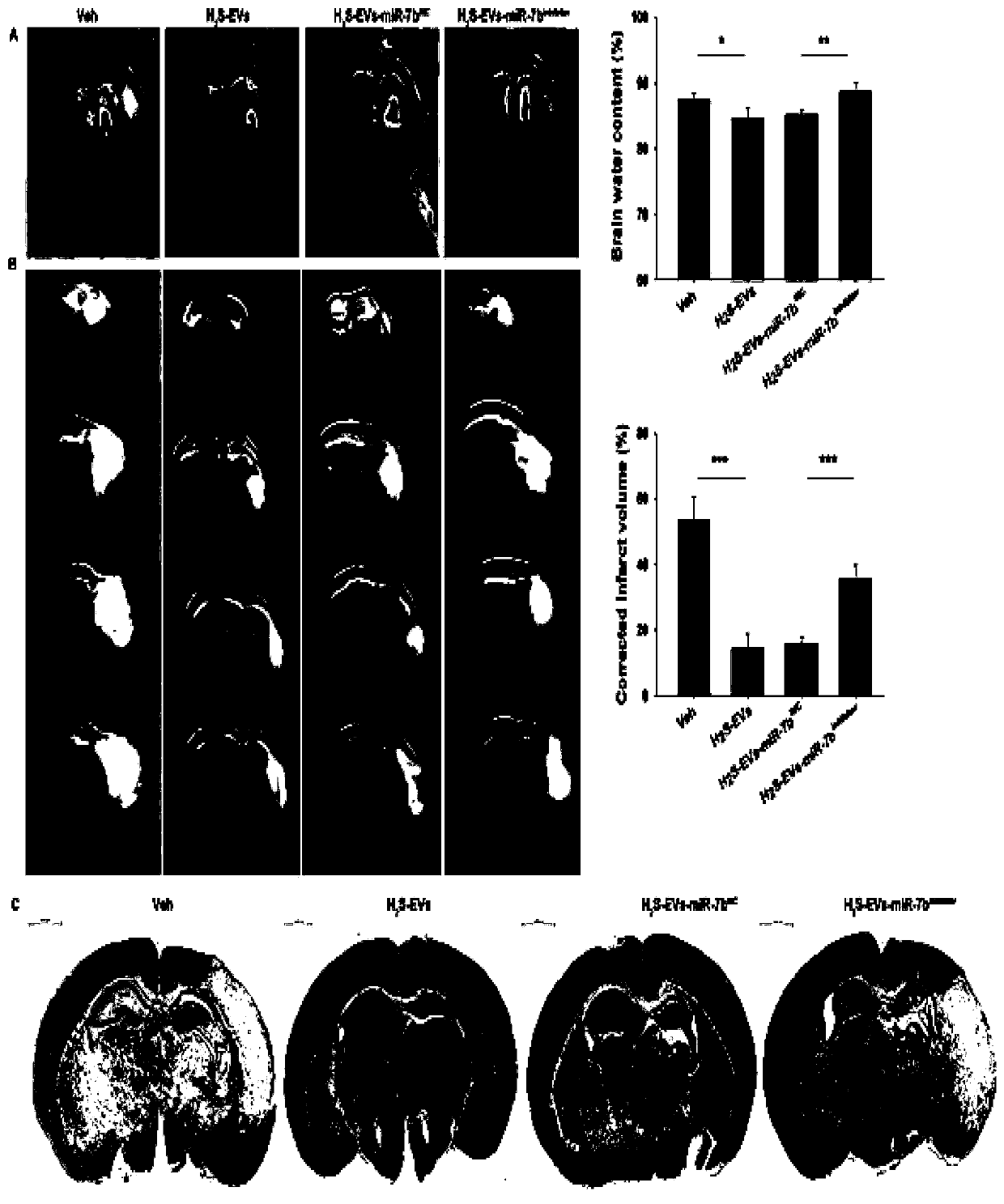 Application of hydrogen sulfide modified mesenchymal stem cells (MSCs) extracellular vesicles (EVs) serving as miRNA delivery vector to hypoxic-ischemic brain damage (HIBD)