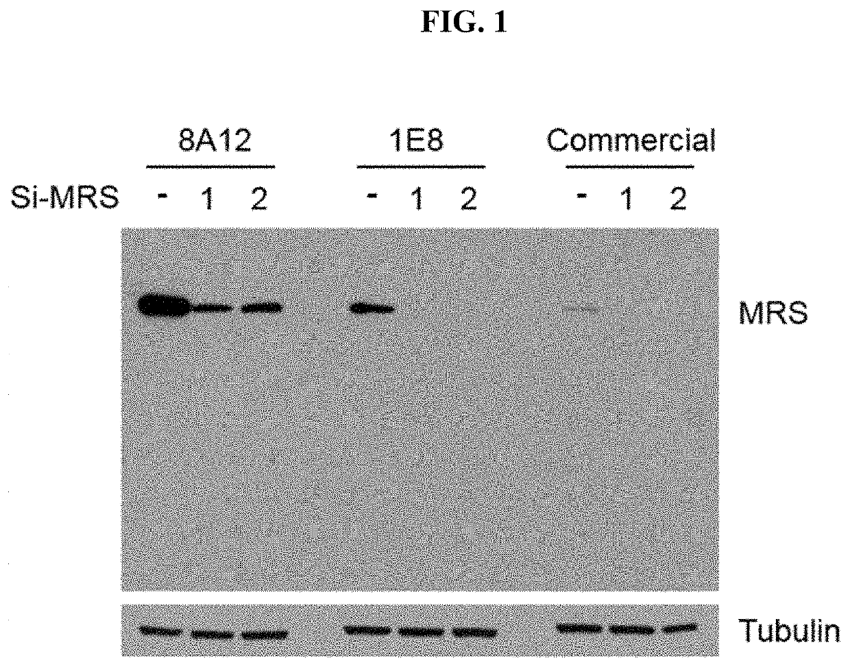 Method for diagnosing pancreatic cancer using methionyl-trna synthetase, and pancreatic cancer diagnostic kit using same