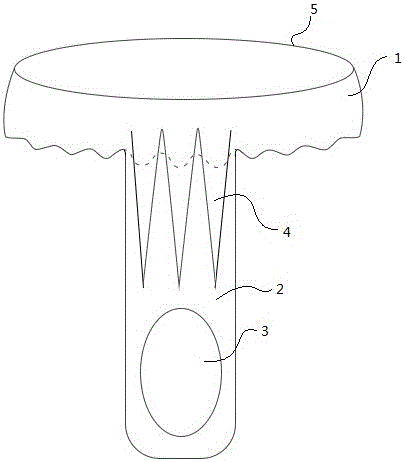 Bottle cap facilitating opening