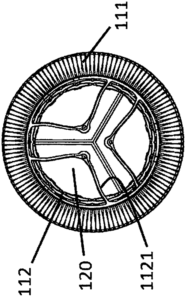 An adaptive heart valve prosthesis