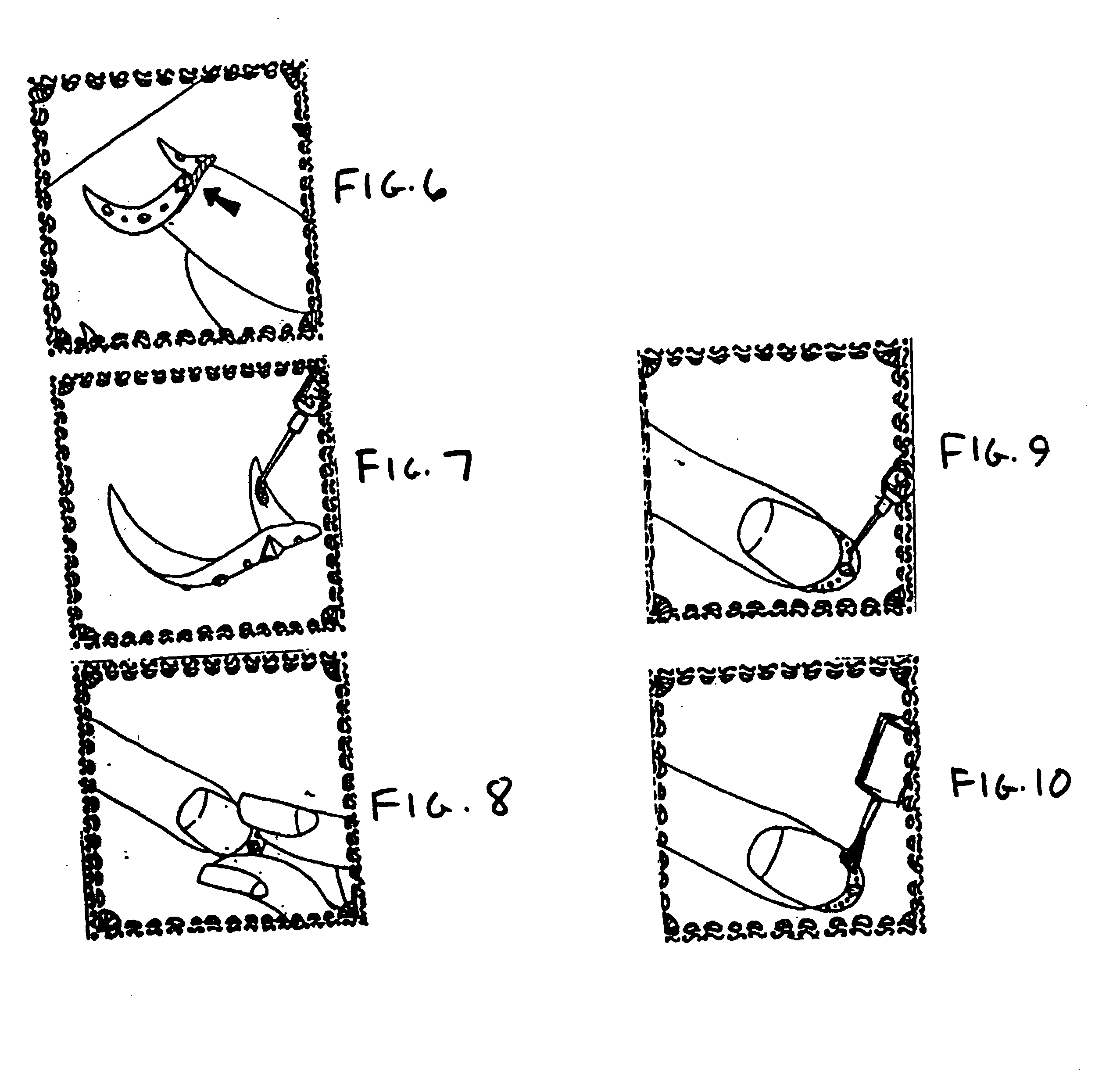 Body applique and method therefor