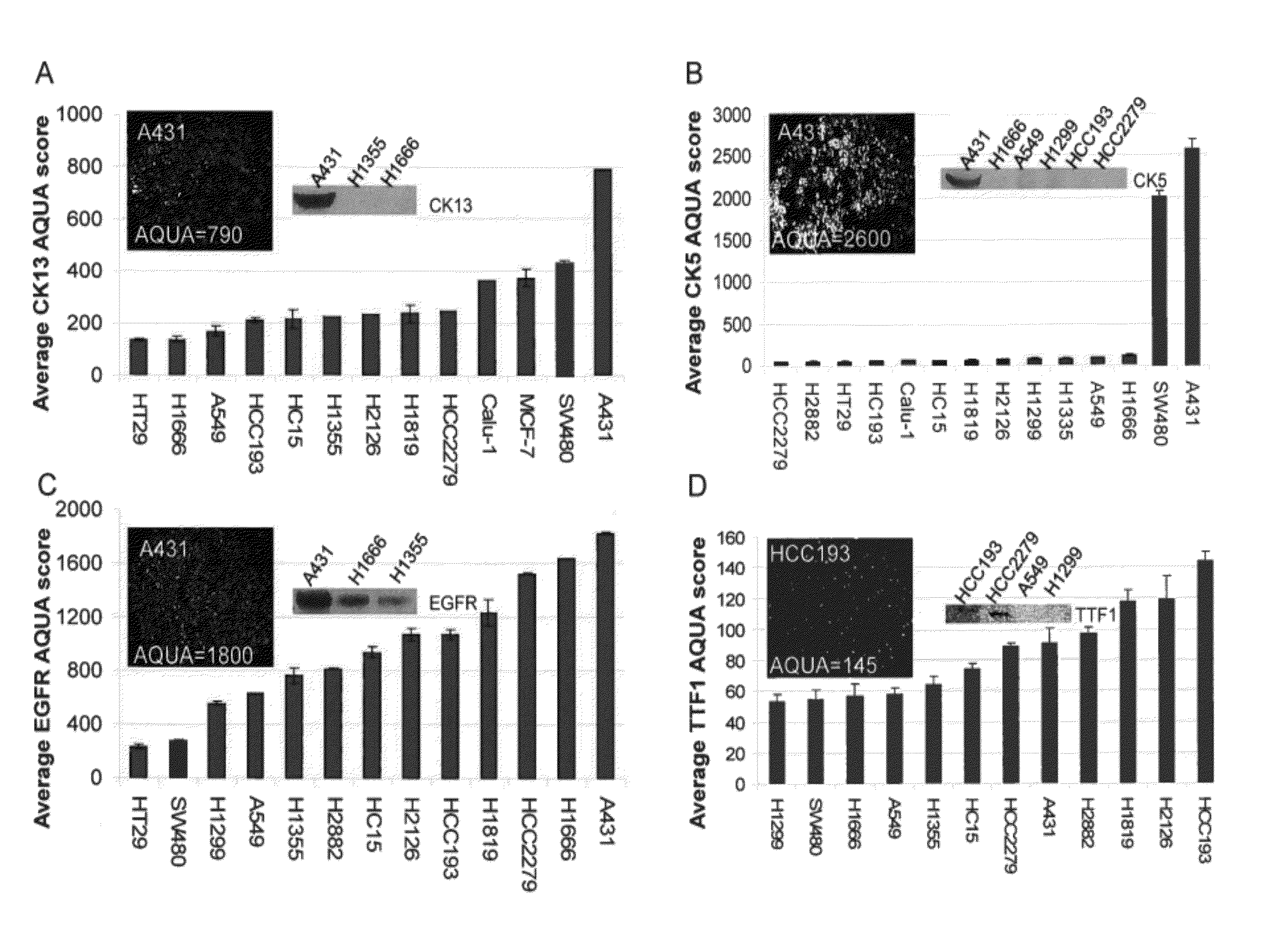 Objective, quantitative method to predict histological subtype in non-small cell lung cancer