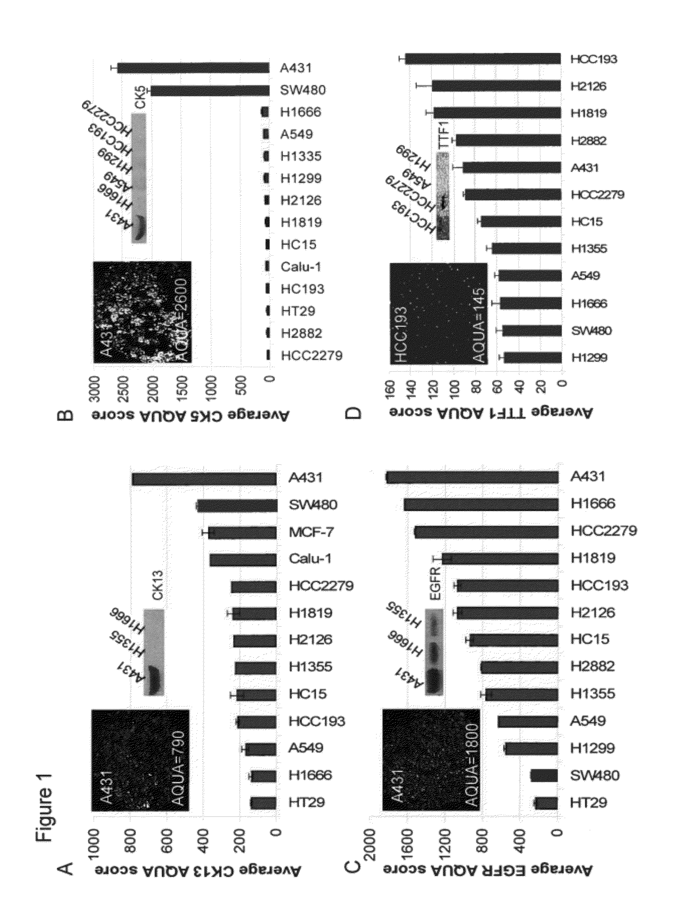 Objective, quantitative method to predict histological subtype in non-small cell lung cancer