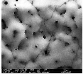 Titanium dioxide-hydroxyapatite gradient coating of medical titanium or titanium alloy surface and preparation method