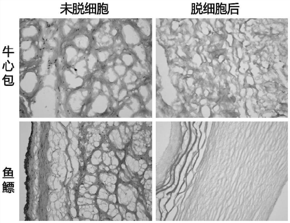 Swim bladder-derived biological valve material and its preparation method and application