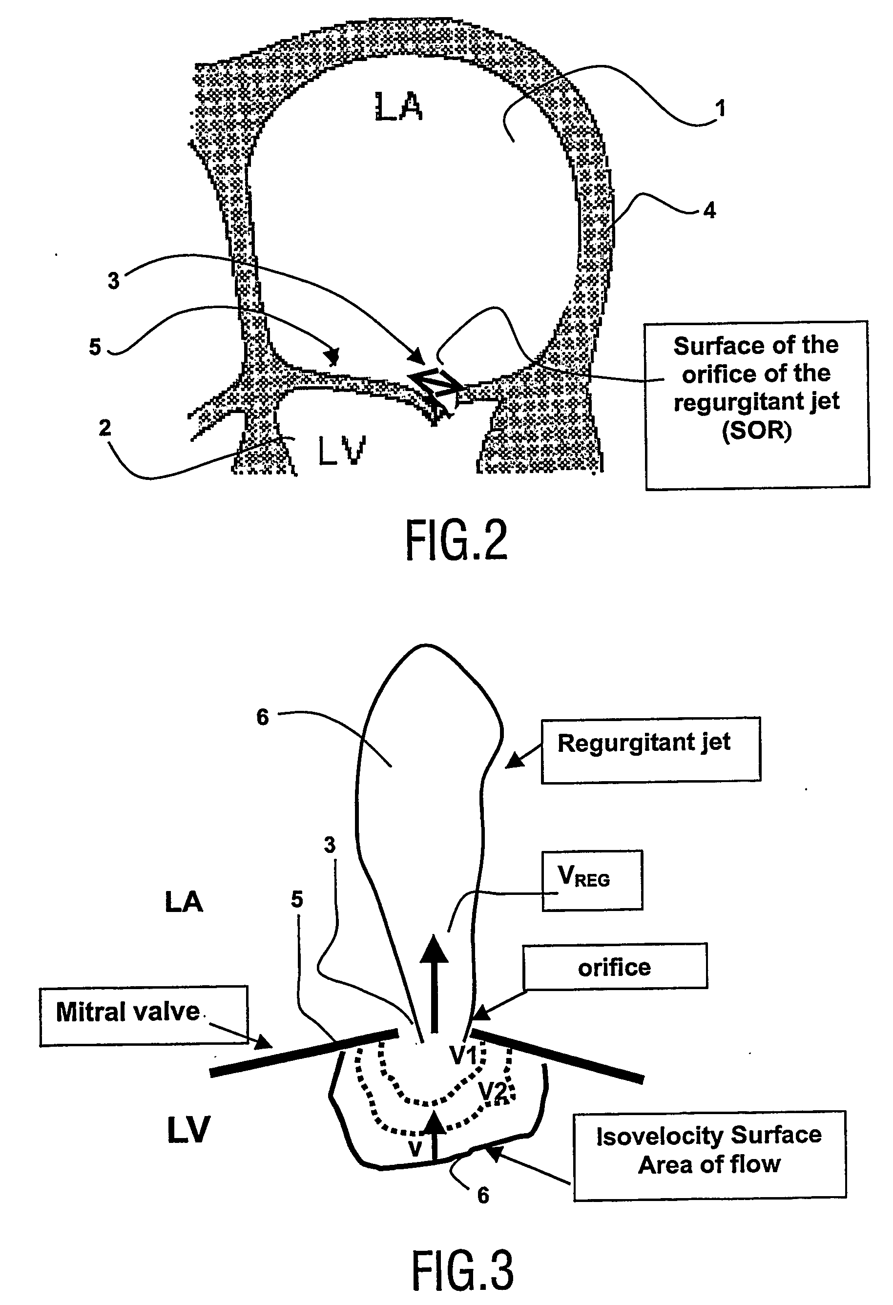 Viewing system having means for processing a sequence of ultrasound images for performing a quantitative estimation of f flow in a body organ