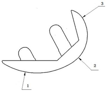 Fixed single-condyle prosthesis with different sagittal plane forms