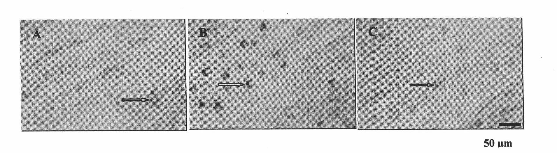 Use of VEGF antibody and VEGF receptor antagonist in preparation of pain-killing vaccine or medicament