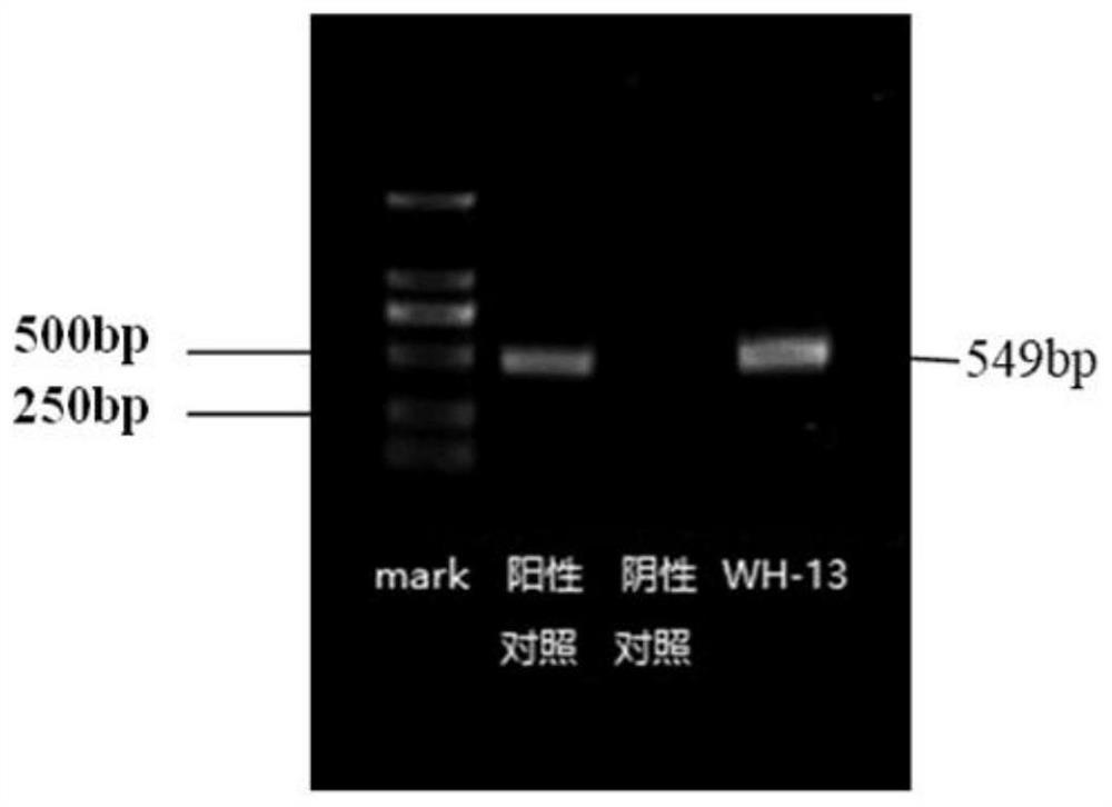 Porcine pseudorabies virus strain and application thereof