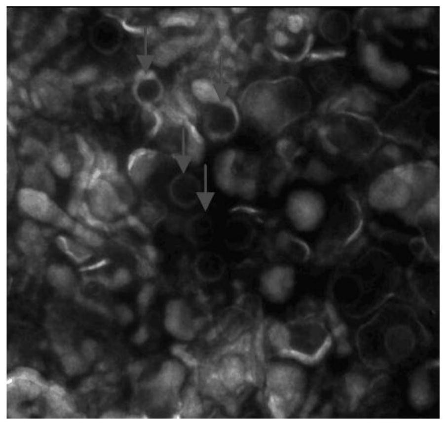 Porcine pseudorabies virus strain and application thereof