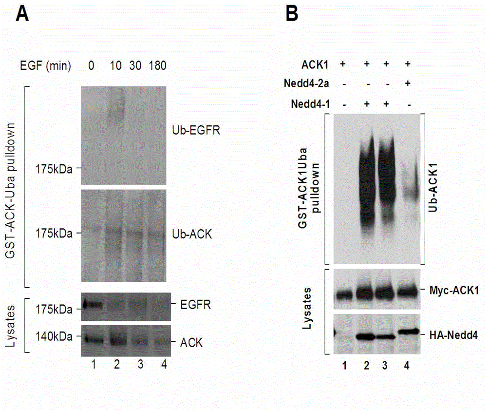 Application of ubiquitin-binding domain fusion protein in detection and separation of ubiquitination protein