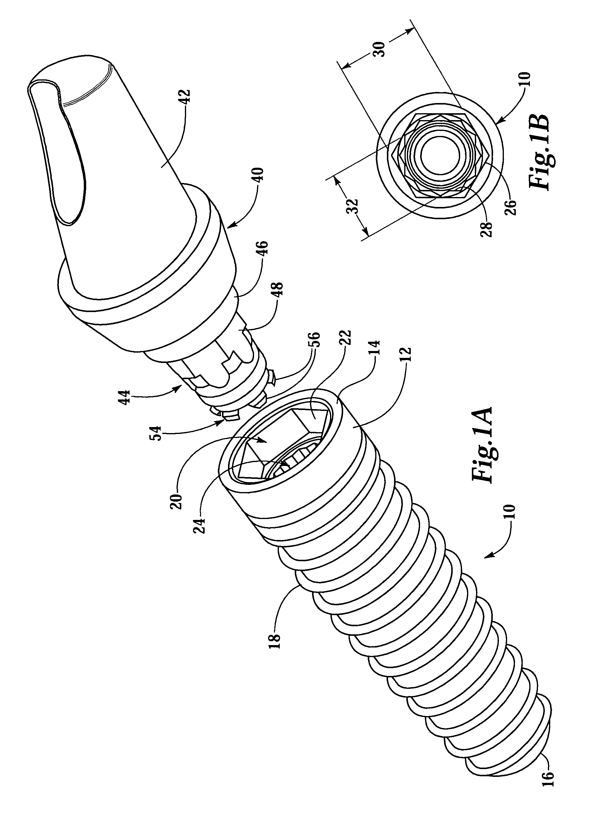 Dental implant system