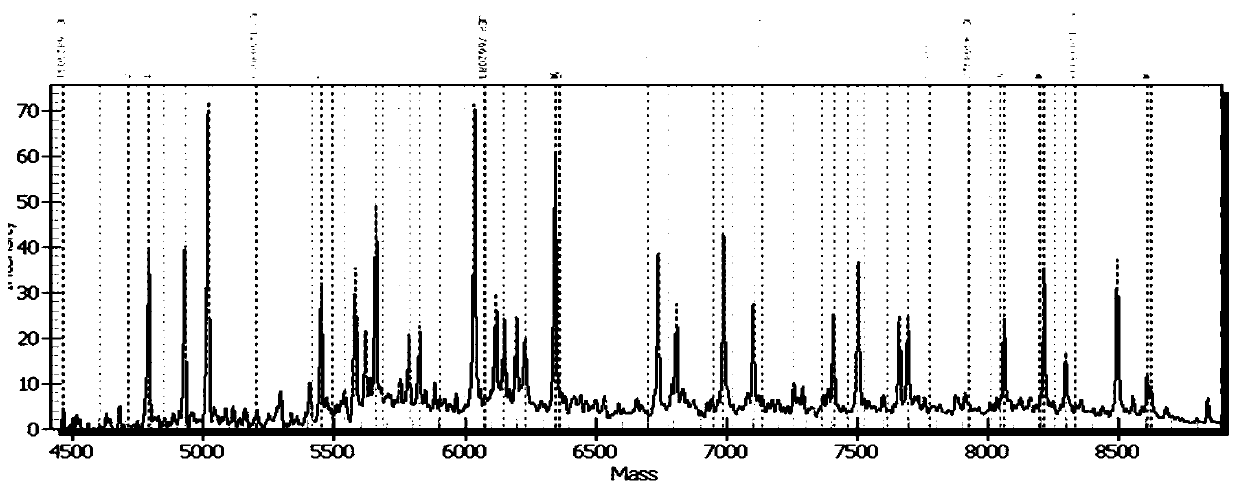 Primer composition for distinguishing individualized medication type of valsartan