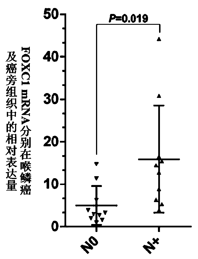 siRNA for FOXC1 gene expression inhibition, and application thereof