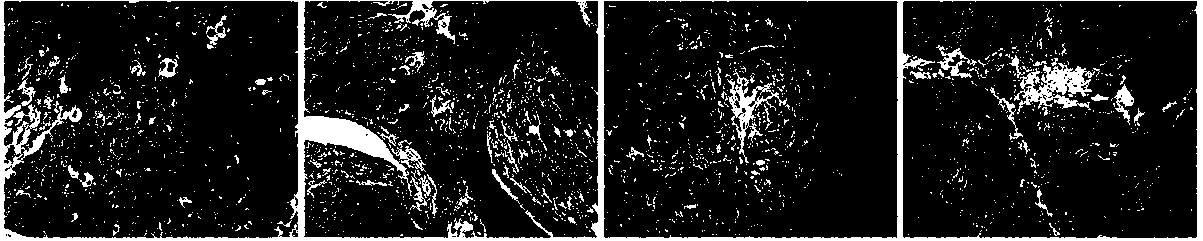 siRNA for FOXC1 gene expression inhibition, and application thereof