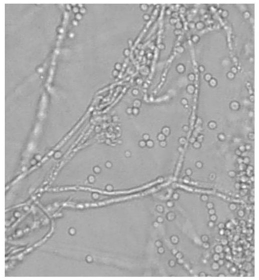 A kind of lavender fungus bacterial strain and application thereof