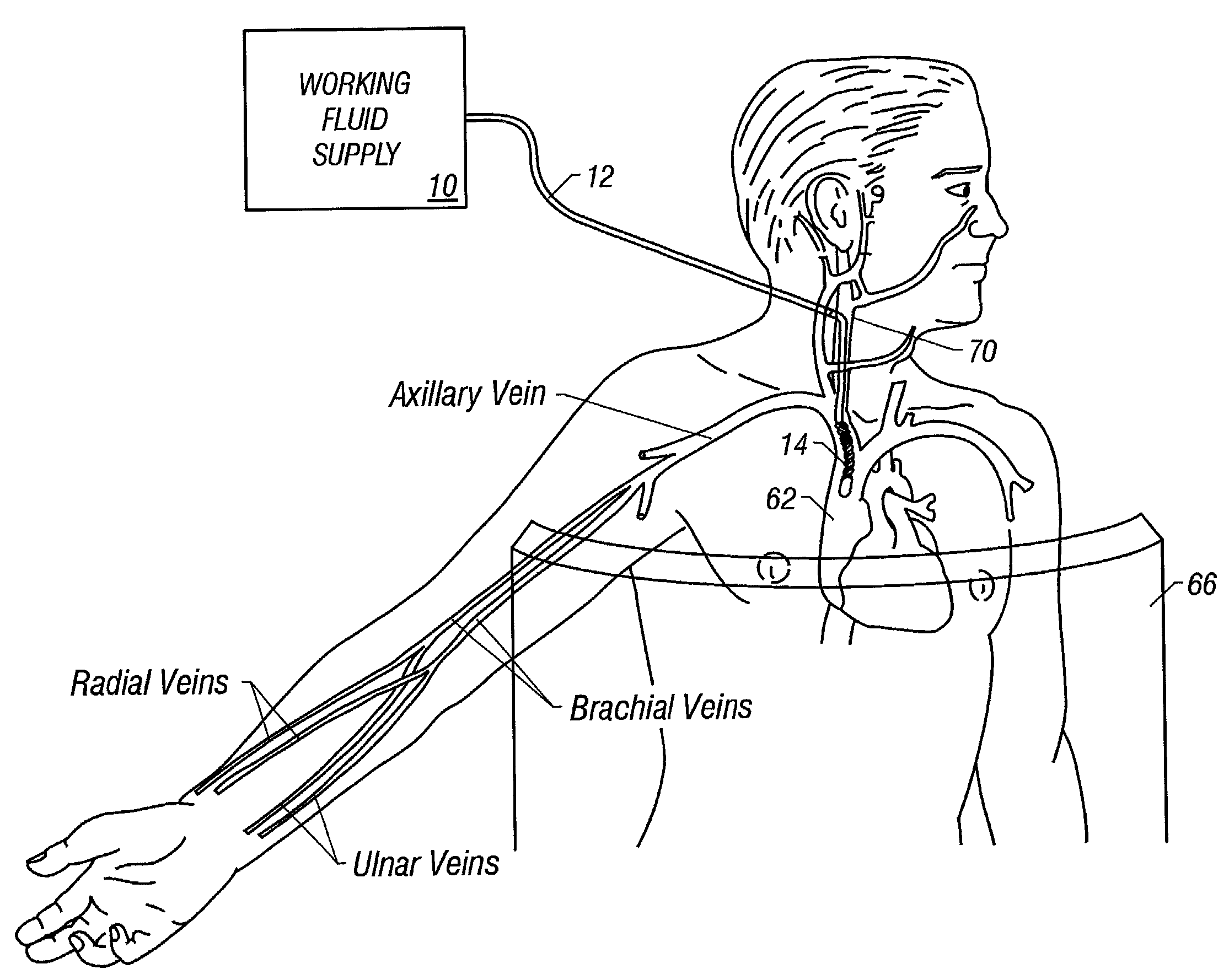 Patient temperature regulation method and apparatus